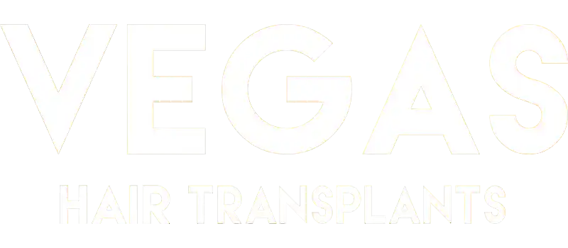 vegas hair transplants